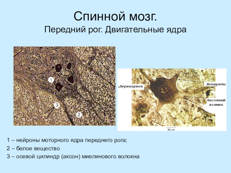 Нейроны спинного мозга. Поперечный срез спинного мозга (нервные клетки) -. Передний Рог спинного мозга гистология. Ядра спинного мозга препарат гистология. Нейроны передних Рогов спинного мозга.