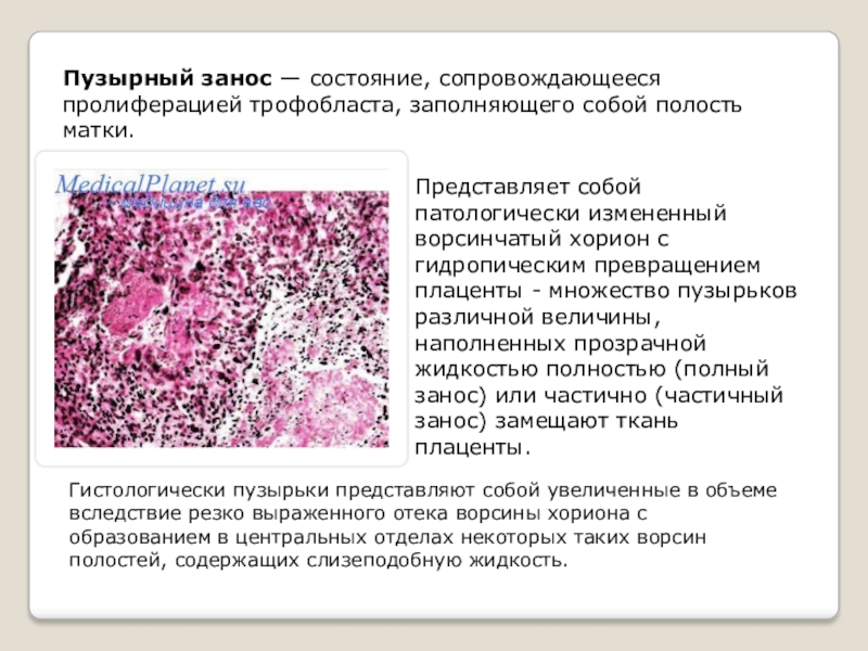 Морфологическая картина нарушенной маточной беременности что это значит у женщин