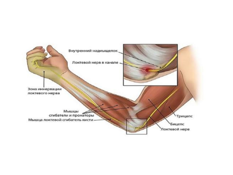 Локтевой нерв фото