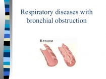 Respiratory diseases with bronchial obstruction