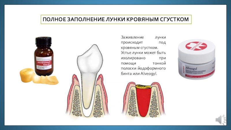 Можно полоскать фурацилином после удаления зуба