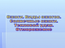 Ожоги. Виды ожогов.
Солнечные ожоги.
Тепловой удар.
Отморожение