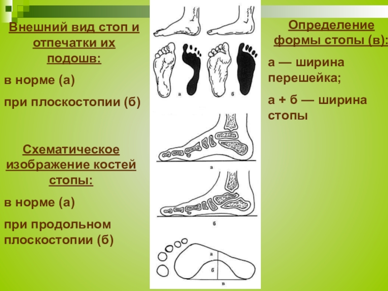 Рассмотрите рисунок 1 и 2 с изображением стоп человека
