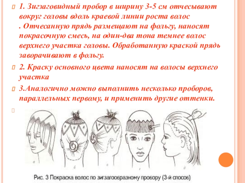 Линия роста волос. Краевая линия роста волос. Краевая линия роста волос; пробор. Строение краевой линии роста волос. Перечислите краевой линии роста волос.