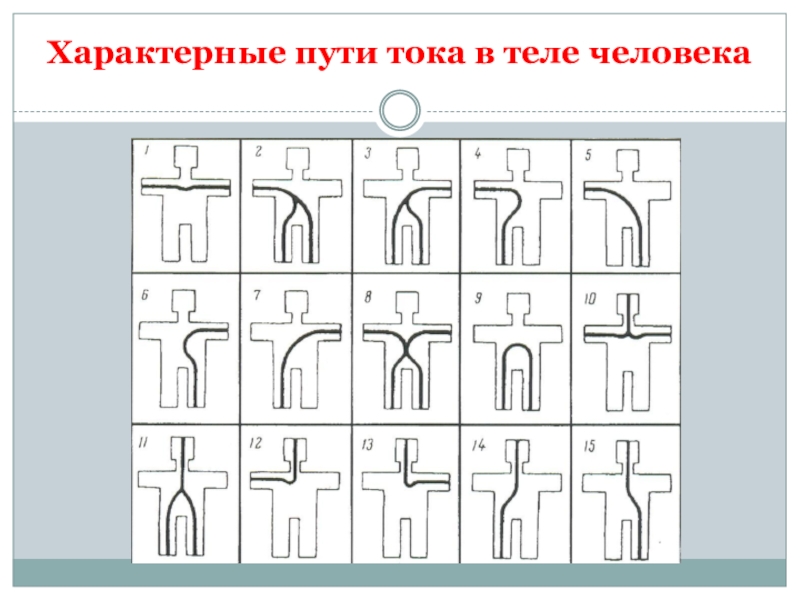 Опасный путь протекания электротока через человека