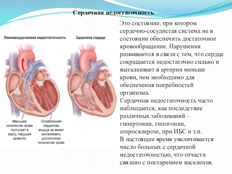 Исследовательский проект сердечно сосудистые заболевания