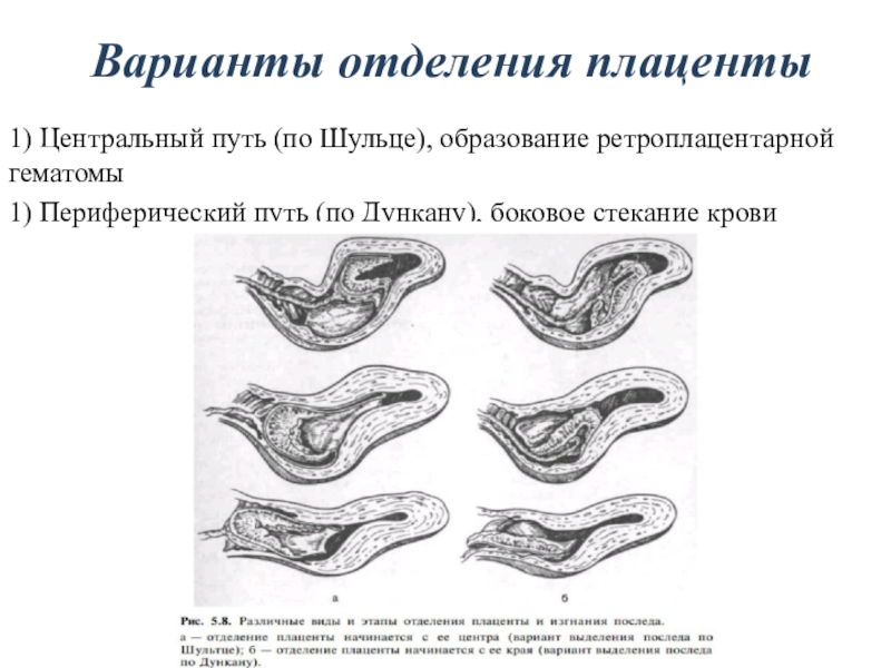 Периоды родов акушерство презентация