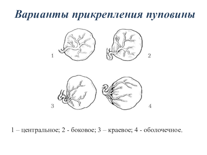 Аномалии развития плаценты презентация