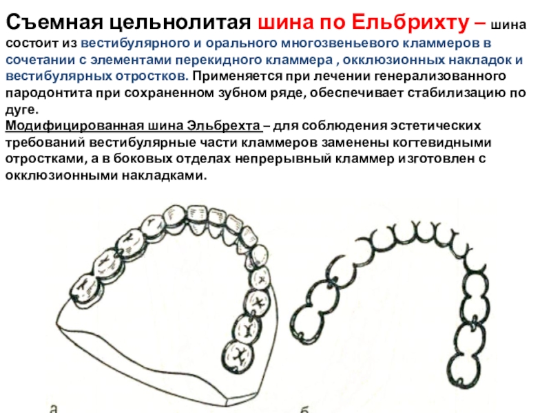 Показания к применению кламмеров