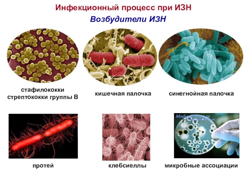 Возбудители инфекционных заболеваний презентация