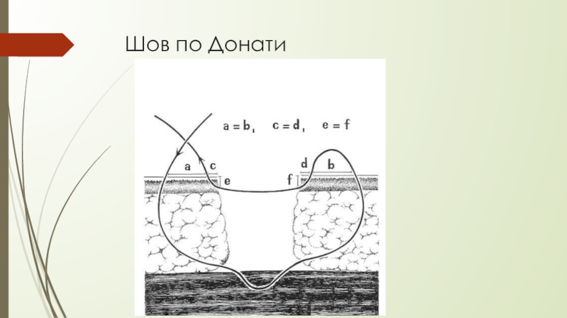 Шов донати схема