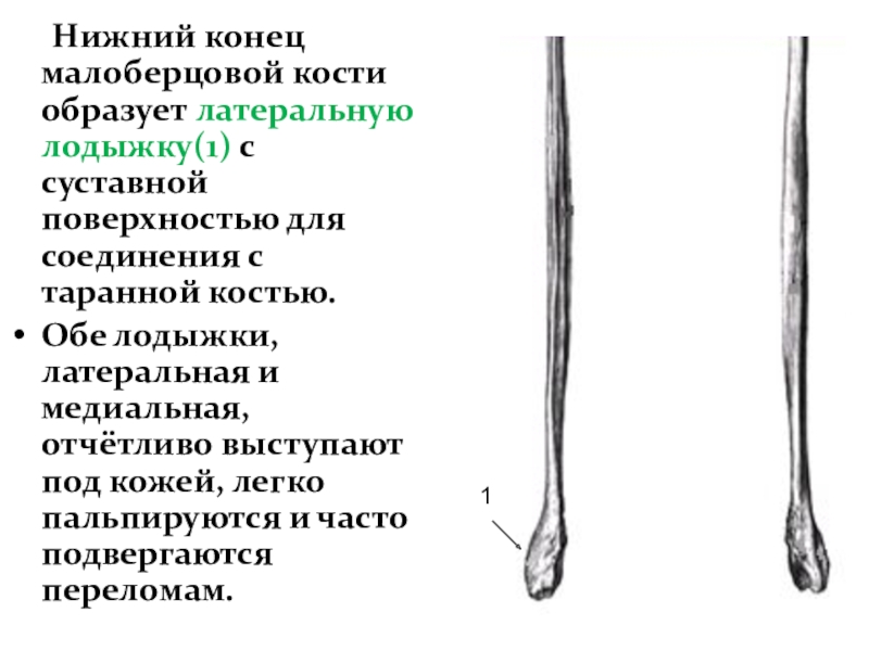 Малоберцовая нейропатия код по мкб 10. Малоберцовая кость анатомия человека медиально. Малоберцовая кость латеральная лодыжка. Суставная поверхность для соединения с малоберцовой костью. Кости верхних и нижних конечностей.