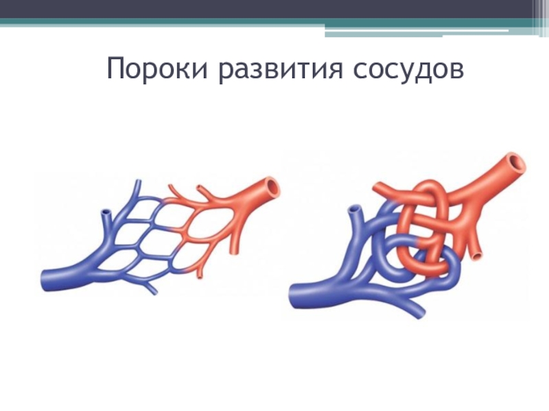 Врожденный венозный порок. Артериовенозная мальформация. Сосудистая мальформация капиллярная. Венозная мальформация печени. Артериально венозная мальформация.