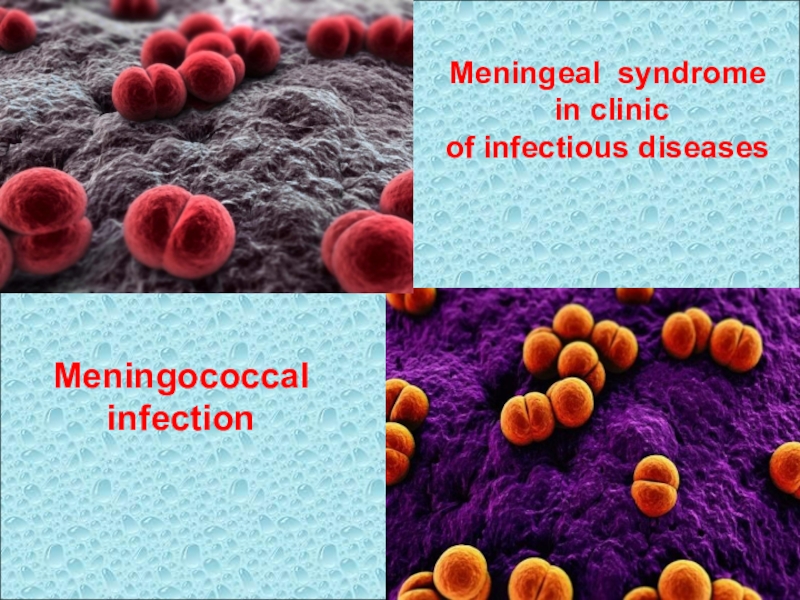 Мeningeal syndrome
in clinic
of infectious diseases
Meningococcal infection