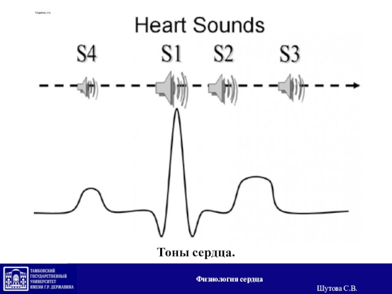 Звуки тона сердца