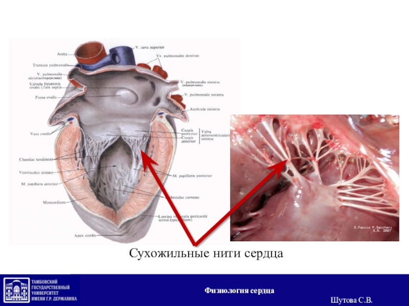 Наличие хорды у человека. Строение сердца анатомия хорда. Сухожильные нити сердца анатомия. Сухожильные хорды сердца анатомия. Сосочковые мышцы и сухожильные нити на схеме сердца.