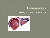 Печёночная недостаточность