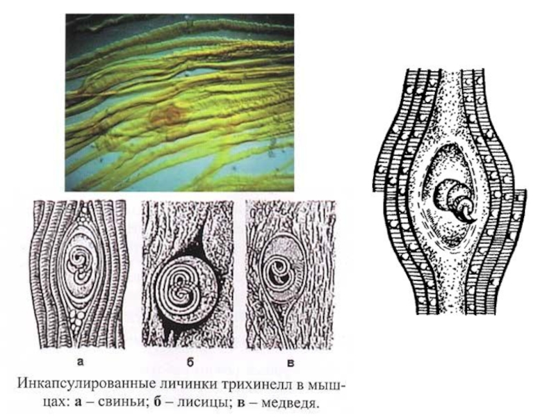 Трихинелла личинка в мышцах рисунок