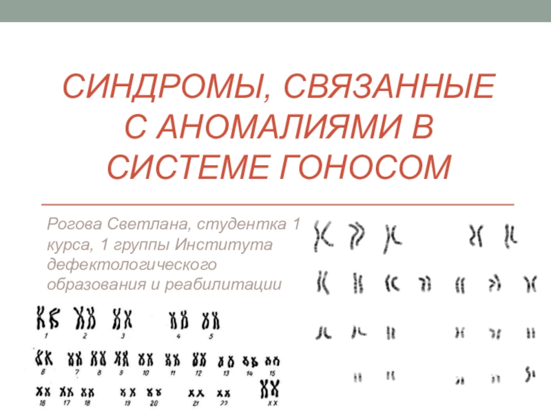 Презентация Синдромы, связанные с аномалиями в системе гоносом