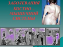 ЗАБОЛЕВАНИЯ
КОСТНО – МЫШЕЧНОЙ СИСТЕМЫ