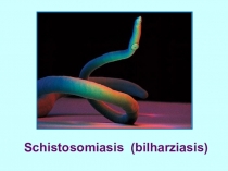 Schistosomiasis ( bilharziasis )
