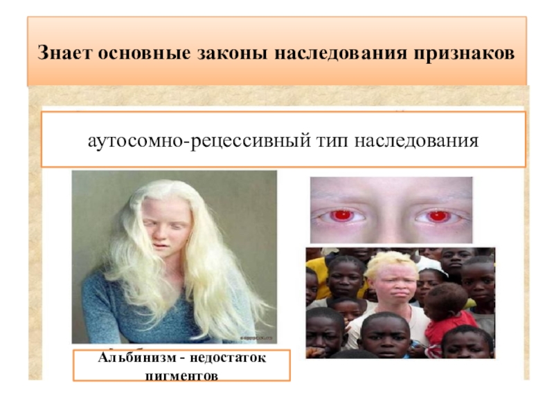Аутосомно рецессивные наследственные заболевания. Схема наследования альбинизма. Альбинизм Тип наследования признака. Аутосомно-рецессивный Тип наследования альбинизма. Альбинизм наследственность.