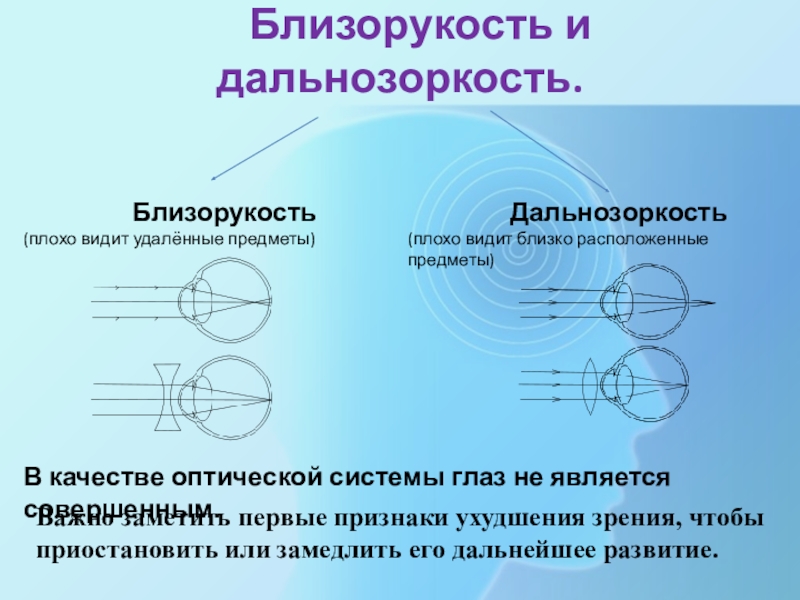 Презентация близорукость и дальнозоркость 8 класс