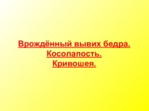 Врождённ ы й вывих бедра. Косолапость.
Кривошея