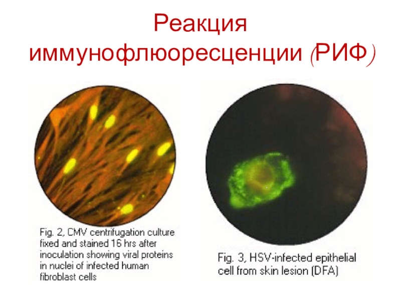 Реакция иммунофлюоресценции презентация