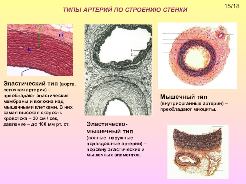 Типы артерий. Артерия мышечно-эластичного тпиа гистология. Артерия мышечного и эластического типа гистология. Строения стенки артерии мышечного и эластического типа. Артерия эластического типа аорта.