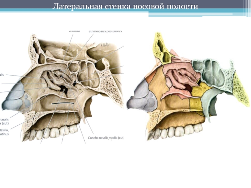 Полость носа стенки. Латеральная стенка носовой полости. Медиальная стенка носовой полости. Костный скелет латеральной стенки полости носа. Латеральная стенка полости носа.