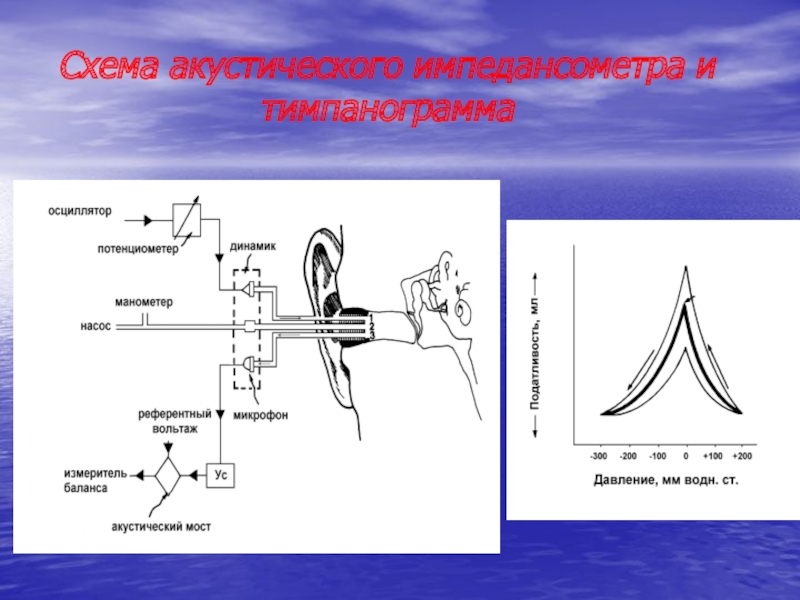 Схема акустического импедансометра и тимпанограмма